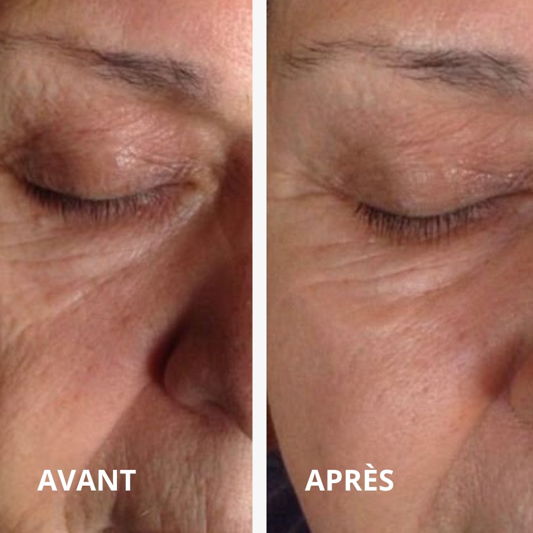 Effet collagene