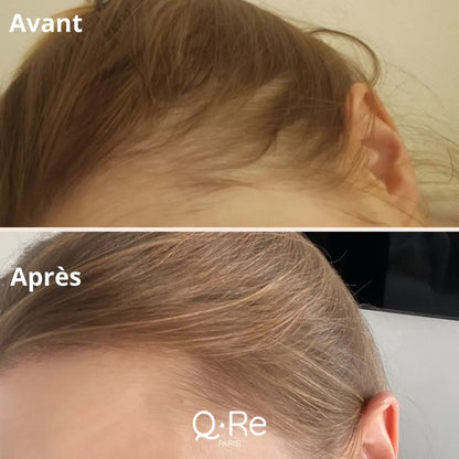 POUR LES CHEVEUX & LES ONGLES (L'ANTI-CHUTE) Q.Re Paris